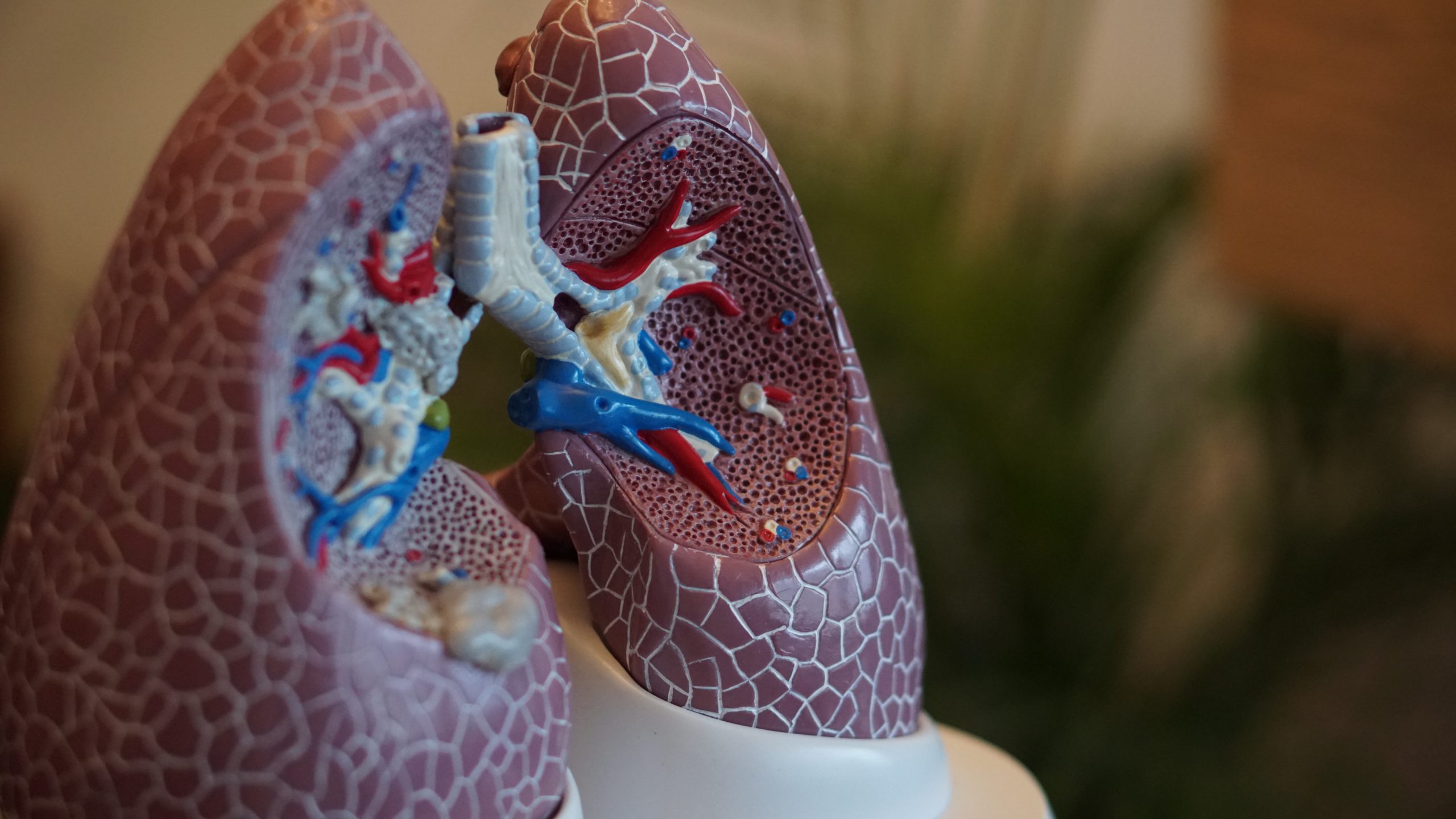 Progetto DEFLeCT “Digital tEchnology For Lung Cancer Treatment”